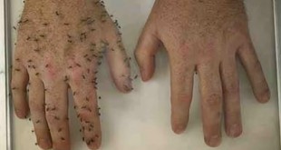 repelente natural de mosquitos y hormigas